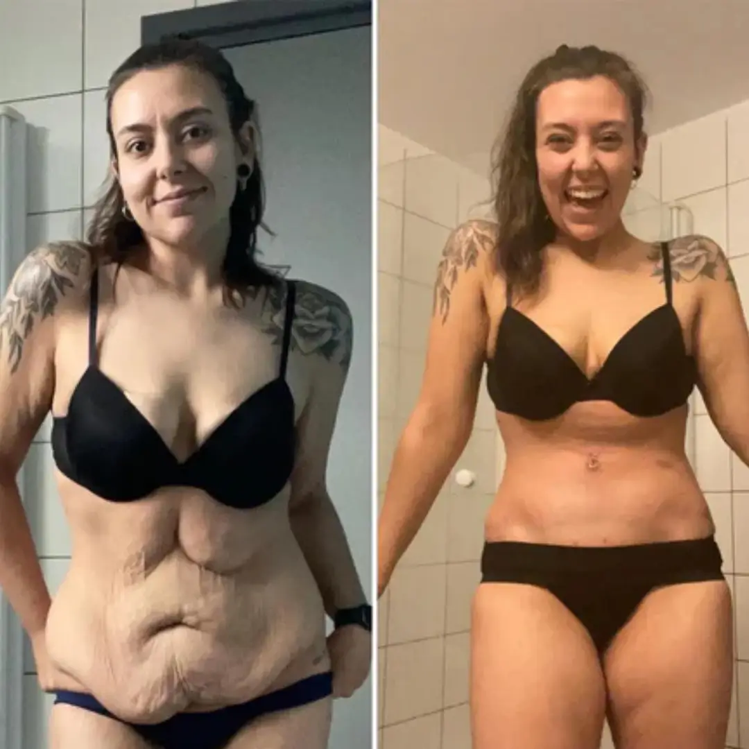 Before and after with XeiuC Collagen Oil